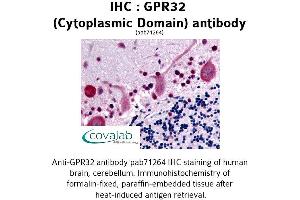 Image no. 1 for anti-G Protein-Coupled Receptor 32 (GPR32) (3rd Cytoplasmic Domain) antibody (ABIN1735060) (GPR32 antibody  (3rd Cytoplasmic Domain))