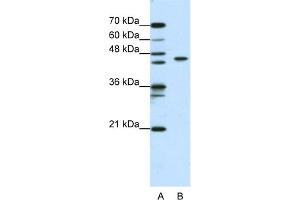 WB Suggested Anti-ZBTB9 Antibody Titration:  0.