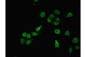 Immunofluorescent analysis of A549 cells using ABIN7168333 at dilution of 1:100 and Alexa Fluor 488-congugated AffiniPure Goat Anti-Rabbit IgG(H+L) (RBM12 antibody  (AA 1-200))