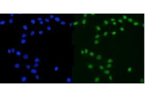 IF analysis of ATXN3 using anti-ATXN3 antibody (ABIN3043796).