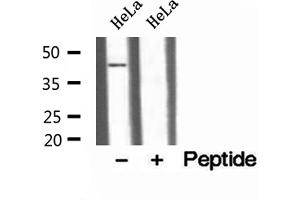 Western blot analysis of extracts of HeLa cells, using TTL antibody. (TTL antibody)