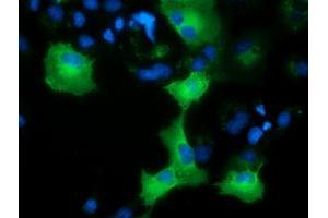 Immunofluorescence (IF) image for anti-Adenylate Kinase 5 (AK5) antibody (ABIN1496533) (Adenylate Kinase 5 antibody)