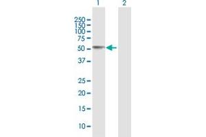 Western Blot analysis of CCM2 expression in transfected 293T cell line by CCM2 MaxPab polyclonal antibody. (CCM2 antibody  (AA 1-444))