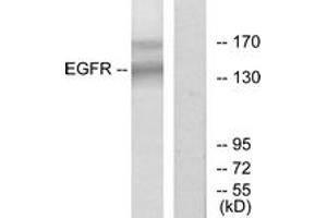 Western blot analysis of extracts from HT-29 cells, using EGFR (Ab-1172) Antibody.