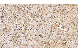Detection of PIIINP in Human Cardiac Muscle Tissue using Monoclonal Antibody to Procollagen III N-Terminal Propeptide (PIIINP)