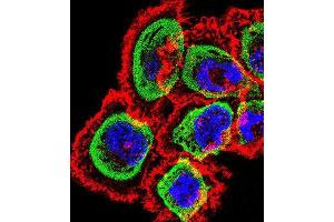 Immunofluorescence (IF) image for anti-Regulator of Calcineurin 1 (RCAN1) antibody (ABIN2998994) (RCAN1 antibody)