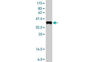 Western Blot detection against Immunogen (38. (MAGI2 antibody  (AA 519-628))