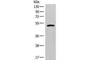 Western blot analysis of Human fetal liver tissue lysate using FBXO9 Polyclonal Antibody at dilution of 1:200 (FBXO9 antibody)