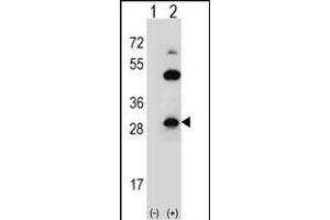 Western blot analysis of CLDN2 (arrow) using rabbit polyclonal CLDN2 Antibody  (ABIN656564 and ABIN2845824). (Claudin 2 antibody  (C-Term))