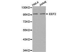 Western Blotting (WB) image for anti-Eukaryotic Translation Elongation Factor 2 (EEF2) antibody (ABIN1872437) (EEF2 antibody)