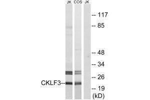 Western blot analysis of extracts from Jurkat cells and COS cells, using CKLF3 antibody. (CMTM3 antibody  (N-Term))