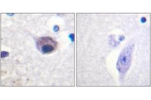 Immunohistochemistry analysis of paraffin-embedded human brain, using VAV2 (Phospho-Tyr142) Antibody. (VAV2 antibody  (pTyr142))