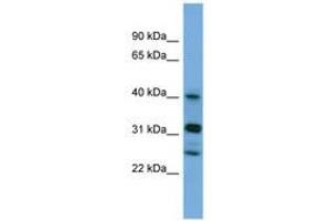 Image no. 1 for anti-Periphilin 1 (PPHLN1) (N-Term) antibody (ABIN6745665) (PPHLN1 antibody  (N-Term))