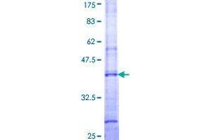 UGT1A4 Protein (AA 34-128) (GST tag)