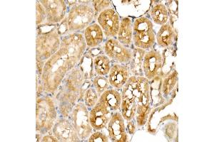 Immunohistochemistry of paraffin-embedded rat kidney using PGC1α Rabbit mAb  at dilution of 1:1000 (40x lens). (PPARGC1A antibody)