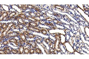 Detection of GPX1 in Rat Kidney Tissue using Polyclonal Antibody to Glutathione Peroxidase 1 (GPX1) (Glutathione Peroxidase 1 antibody  (AA 48-201))