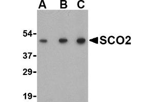 Western blot analysis of SCO2 in human liver tissue lysate with SCO2 antibody at (A) 0.