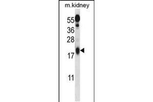 Western blot analysis in mouse kidney tissue lysates (35ug/lane). (UFC1 antibody  (C-Term))