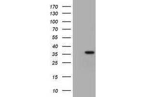 HEK293T cells were transfected with the pCMV6-ENTRY control (Left lane) or pCMV6-ENTRY UBXN10 (Right lane) cDNA for 48 hrs and lysed. (UBXN10 antibody)