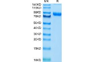 SDS-PAGE (SDS) image for Transferrin Receptor (p90, CD71) (TFRC) (AA 89-760) protein (His tag) (ABIN7275698)