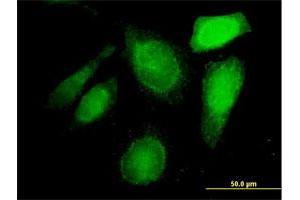 Immunofluorescence of purified MaxPab antibody to C20orf132 on HeLa cell. (C20orf132 antibody  (AA 1-608))