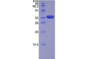 SDS-PAGE analysis of Human TRAF5 Protein. (TRAF5 Protein)