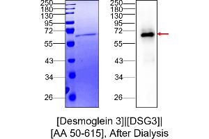 Western Blotting (WB) image for Desmoglein 3 (DSG3) (AA 50-615) protein (His tag) (ABIN3079094)