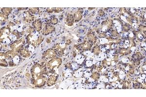 Detection of IFNb in Human Stomach Tissue using Monoclonal Antibody to Interferon Beta (IFNb) (IFNB1 antibody)