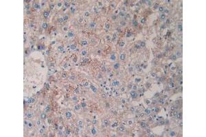 IHC-P analysis of Human Liver Tissue, with DAB staining. (TPSAB1 antibody  (AA 161-262))