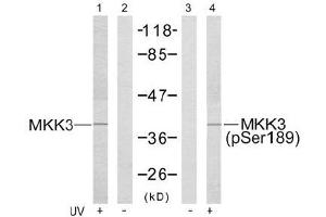 Image no. 3 for anti-Mitogen-Activated Protein Kinase Kinase 3 (MAP2K3) (pSer189) antibody (ABIN196862) (MAP2K3 antibody  (pSer189))