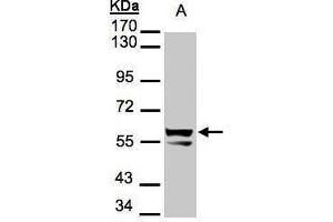 WB Image Sample(30 μg of whole cell lysate) A:A431, 7. (KRT6A antibody)