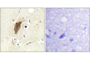 Immunohistochemistry analysis of paraffin-embedded human brain, using Myosin regulatory light chain 2 (Phospho-Ser18) Antibody. (MYL12B antibody  (pSer18))