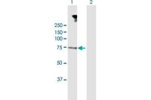 Western Blotting (WB) image for anti-Dystrophia Myotonica-Protein Kinase (DMPK) (AA 1-629) antibody (ABIN950119)
