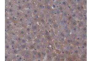 Detection of SHBG in Rat Liver Tissue using Monoclonal Antibody to Sex Hormone Binding Globulin (SHBG) (SHBG antibody  (AA 222-358))