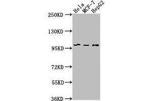 Western Blot Positive WB detected in: Hela whole cell lysate, MCF-7 whole cell lysate, HepG2 whole cell lysate All lanes: EIF4G2 antibody at 1:1000 Secondary Goat polyclonal to rabbit IgG at 1/50000 dilution Predicted band size: 103, 99 kDa Observed band size: 99 kDa (EIF4G2 antibody  (AA 706-907))