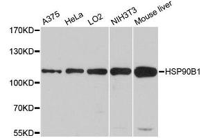 Western blot analysis of extracts of various cell lines, using HSP90B1 antibody. (GRP94 antibody  (AA 550-650))