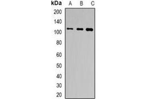 Western blot analysis of TSHR expression in Hela (A), HepG2 (B), HT29 (C) whole cell lysates. (TSH receptor antibody)