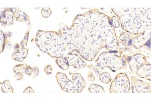 Detection of DSG3 in Human Placenta Tissue using Polyclonal Antibody to Desmoglein 3 (DSG3) (Desmoglein 3 antibody  (AA 858-999))