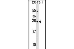 NXNL1 Antibody (Center) (ABIN1538700 and ABIN2849312) western blot analysis in ZR-75-1 cell line lysates (35 μg/lane). (NXNL1 antibody  (AA 94-121))