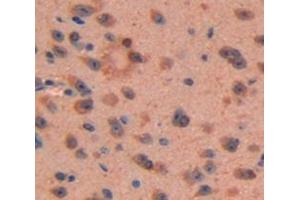 Figure. (CA1 antibody  (AA 15-223))