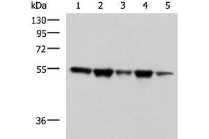 Western blot analysis of A172 Hela HepG2 K562 and PC3 cell lysates using FKBP5 Polyclonal Antibody at dilution of 1:600 (FKBP5 antibody)