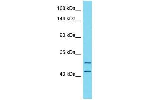 Host:  Rabbit  Target Name:  TTC7A  Sample Type:  Stomach Tumor lysates  Antibody Dilution:  1. (TTC7A antibody  (N-Term))