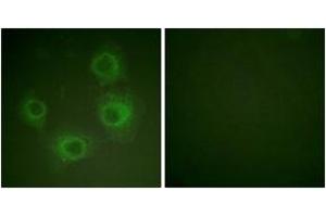 Immunofluorescence analysis of HuvEc cells, using NMDAR2A/B (Phospho-Tyr1246/1252) Antibody. (NMDAR2A + 2B antibody  (pTyr1246))