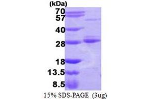 RAB17 Protein (AA 1-212) (His tag)