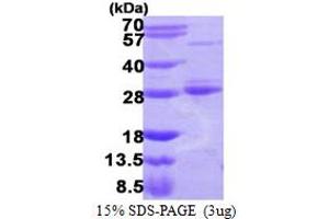 SDS-PAGE (SDS) image for RAB17, Member RAS Oncogene Family (RAB17) (AA 1-212) protein (His tag) (ABIN667487) (RAB17 Protein (AA 1-212) (His tag))