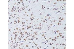Immunohistochemistry of paraffin-embedded Mouse brain using TNFRSF11A Polyclonal Antibody at dilution of 1:100 (20x lens). (TNFRSF11A antibody)