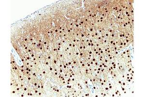 Pyrimidal cells in rat cortex, formalin-fixed paraffin embedded tissue, no pre-treatment, 20X (CAMK4 antibody  (AA 1-241))