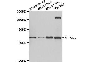Western blot analysis of extracts of various cell lines, using ATP2B2 antibody. (ATP2B2 antibody)
