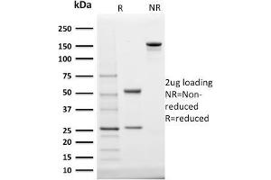 SDS-PAGE Analysis Purified StAR Mouse Monoclonal Antibody (STAR/2140). (STAR antibody  (AA 39-108))