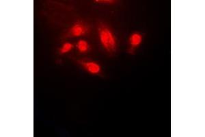 Immunofluorescent analysis of Cofilin staining in HeLa cells. (Cofilin antibody  (N-Term))